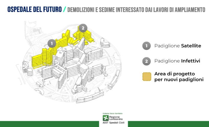 Nuovo ospedale di Brescia